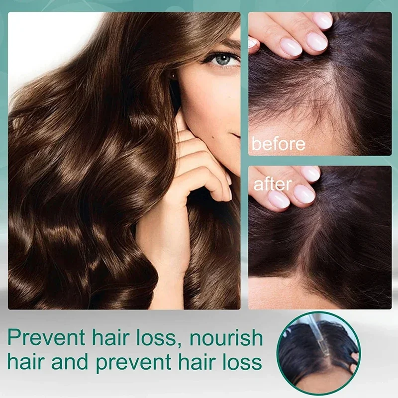 Bakım Sıvısı Dört Ot Doğal İçe - Hair Care Natural Ingredients incelemesi ve fiyatı